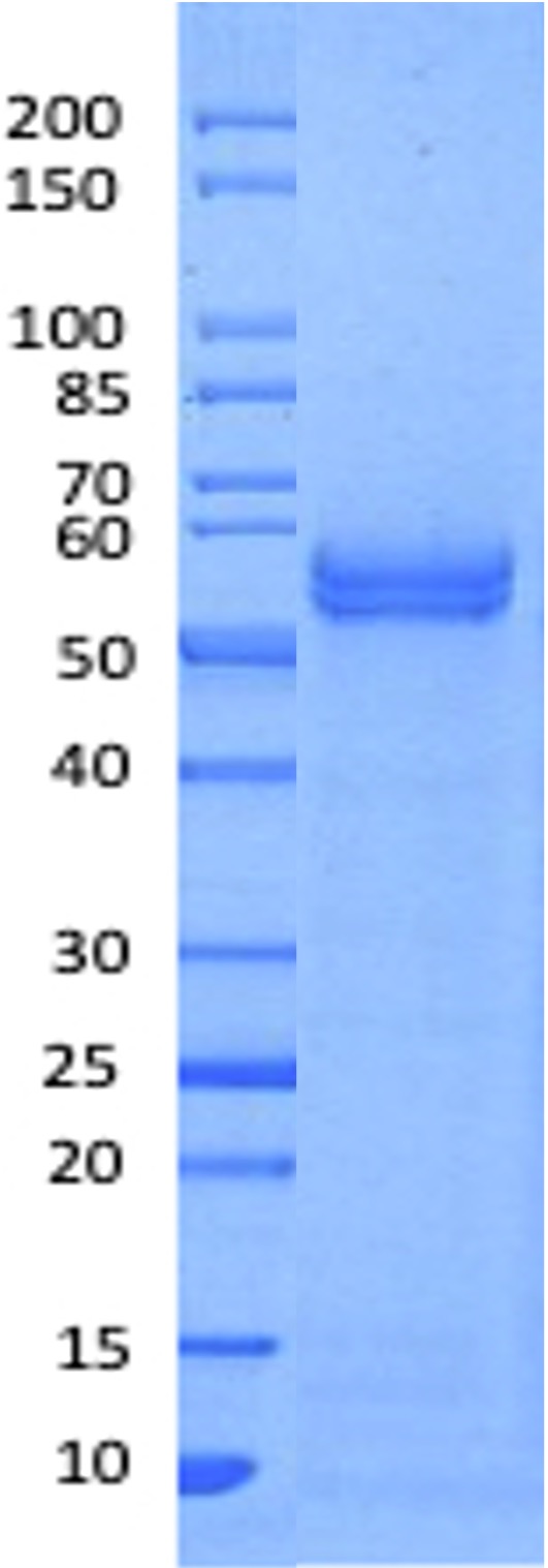 Recombinant Human IL-15 Receptor a & IL-15 Fusion Protein/IL15RA&IL15 (C-Fc)